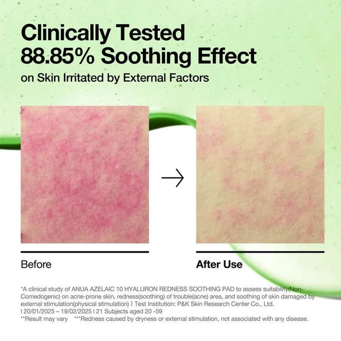 Azelaic Acid 10% Redness Soothing Pads with Hyaluronic Acid - 90pcs