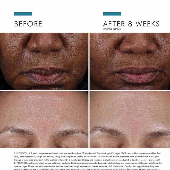 Cell Cycle Catalyst Exfoliating Anti-Aging Skin Renewal Serum - 30ml