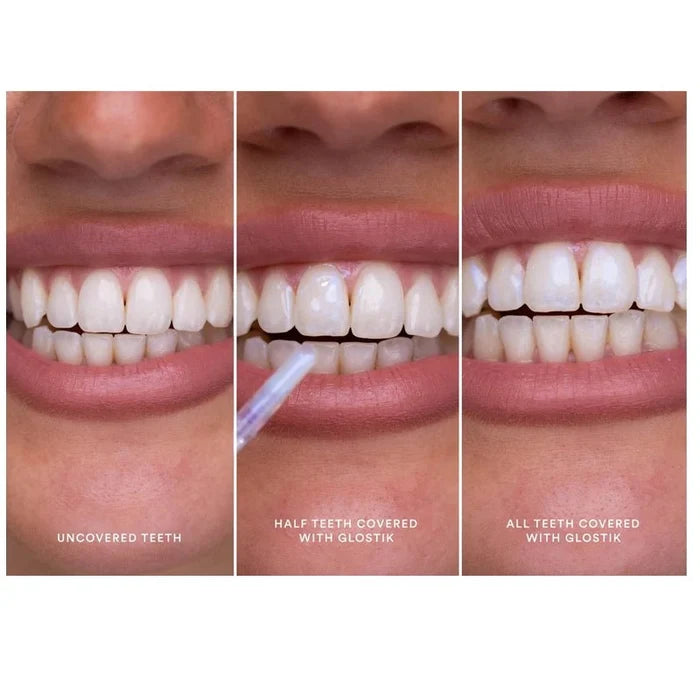 Glostik Instant Teeth Whitening Tooth Gloss - 30ml