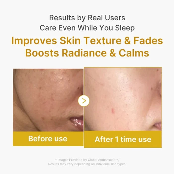 Kojic Acid & Turmeric Brightening Overnight Wrapping Mask - 75ml