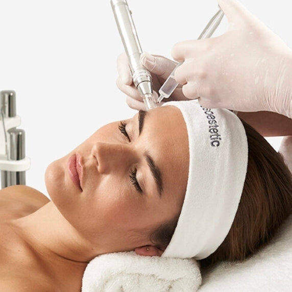 Exquisite Laser Clinic treatment Microneedling Treatment Full Face