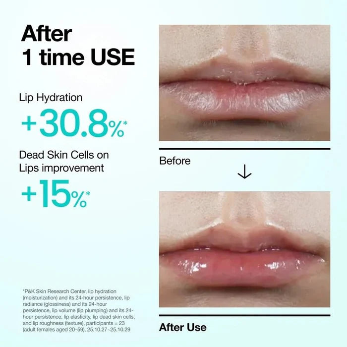 PDRN Lip Serum for Hydration & Plump Glow - 10ml