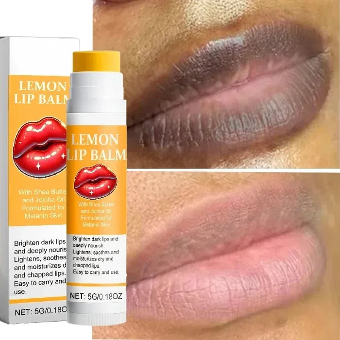 Turmeric Lip Balm