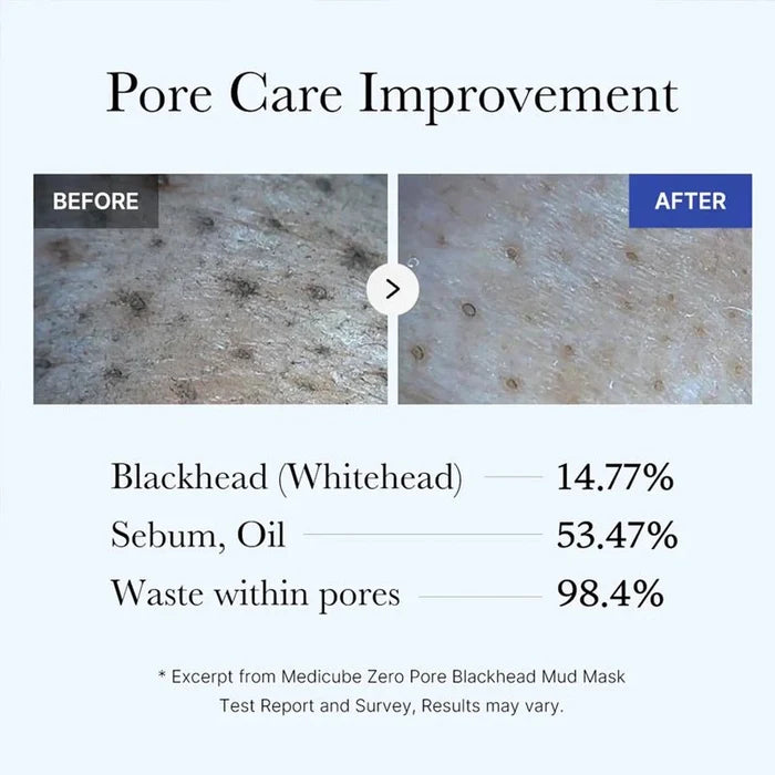 Zero Pore Blackhead Mud Facial Mask for Deep Pore Care - 100g